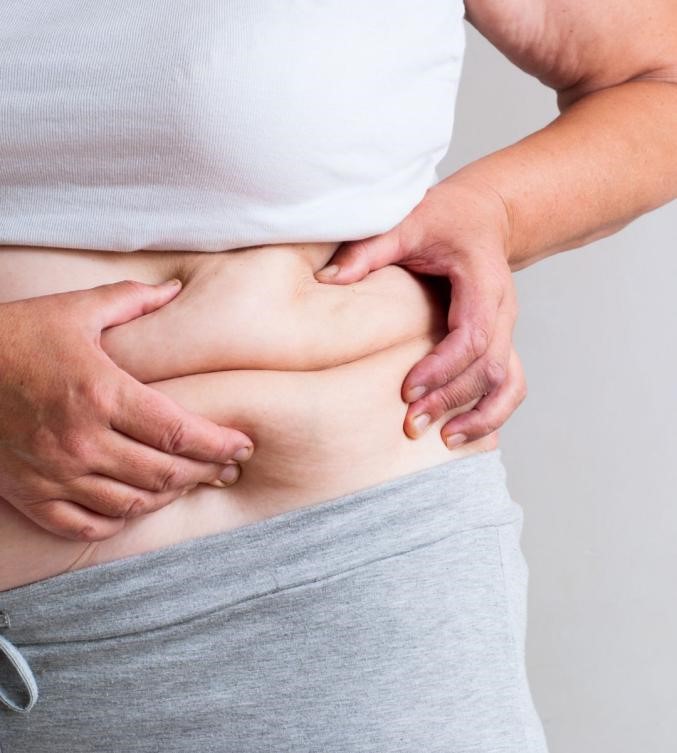 TRIO Sculpt Intense 2