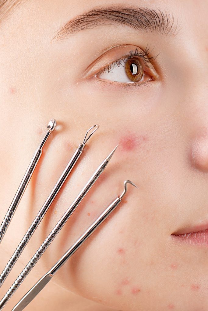 Girl with facial tools scaled
