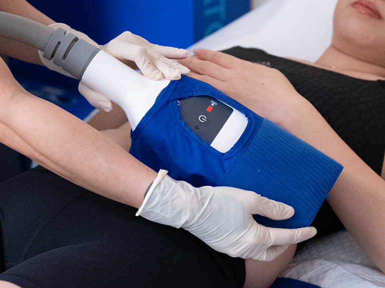 coolsculpt 800 x 600