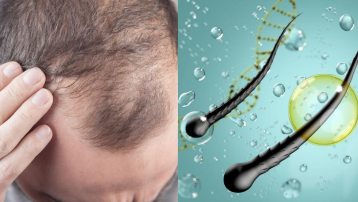 Hair Revival Ritual (Advanced Hair Rejuvenation Therapy) Hair Revival Ritual (Advanced Hair Rejuvenation Therapy)