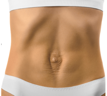 Understanding Smart Fat Reduction