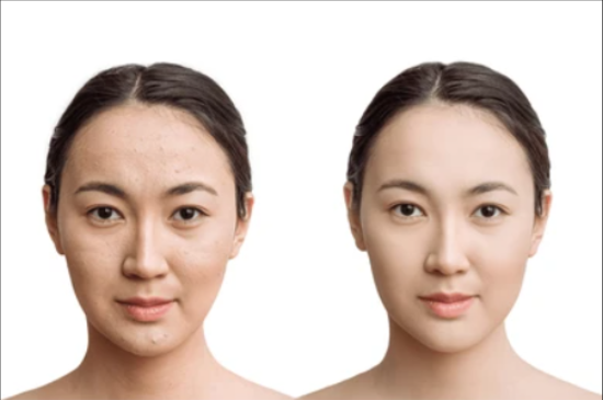 Cellular Aging and Aesthetic Interventions